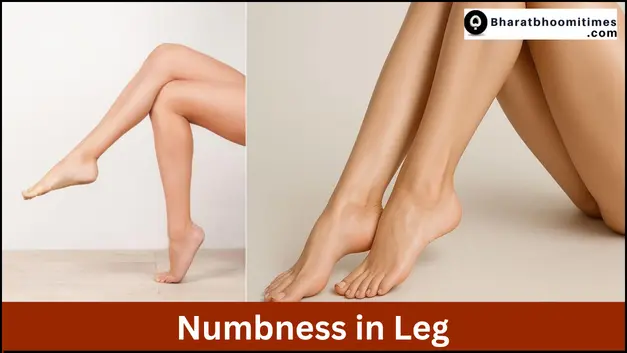 Numbness in Leg